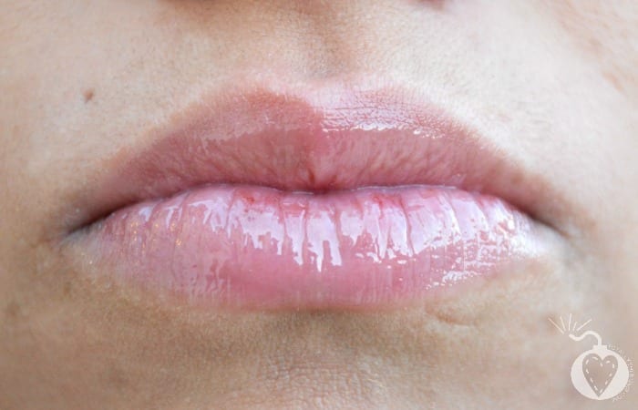 How to Get Fuller Lips Without Collagen Injections