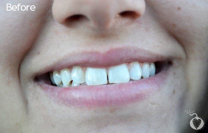 smile before