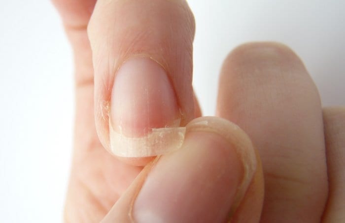 cracked nails usually mean you just need some moisturizer