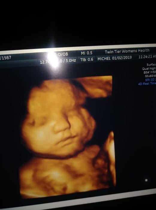 15 Pound Baby