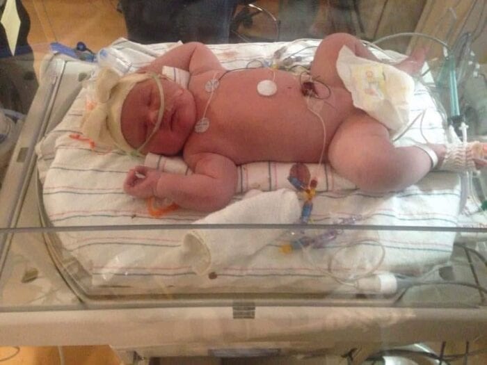 15 Pound Baby