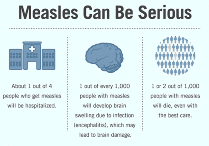 Measles can be serious and you should be prepared
