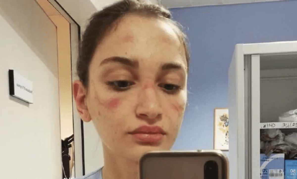How To Soothe Skin Irritation From Wearing A Face Mask