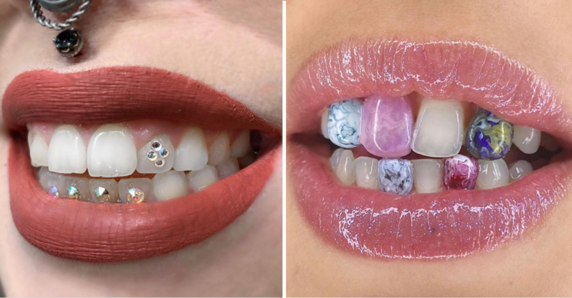 ‘Tooth Gems’ Is The New Hot Beauty Trend and I Don’t Hate Them