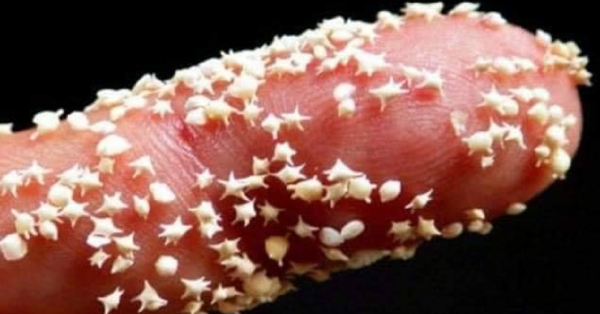 This Beach Has Sand That Is Shaped Like Tiny Stars And Now I Want To Visit