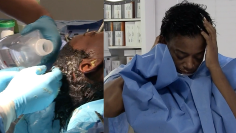 The Woman That Sprayed Her Hair With Gorilla Glue Is Finally Unstuck After Getting Surgery