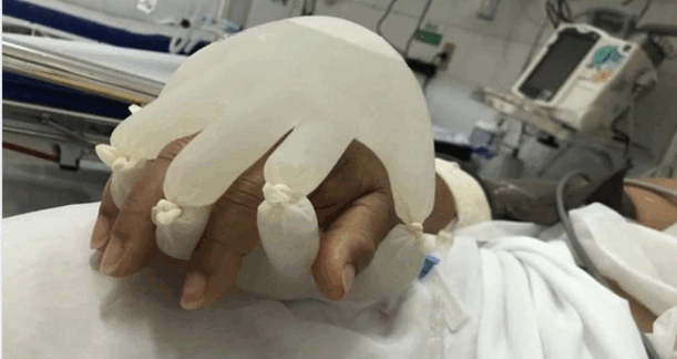 Nurses Are Making Warm Gloves For Covid Patients To Mimic Human Contact And My Heart Is Full
