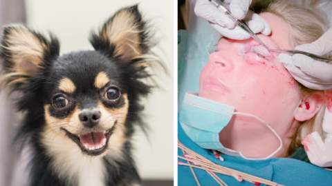 This Girl Got Her Eyelid Ripped Off By A Dog And It Is Terrifying