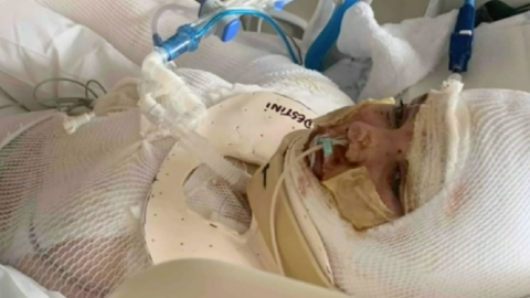 TikTok’s ‘Fire Challenge’ Is Putting Kids In The ER. Here’s What Parents Need to Know.