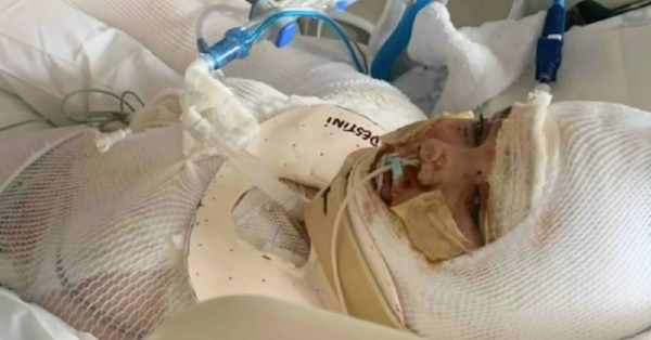TikTok’s ‘Fire Challenge’ Is Putting Kids In The ER. Here’s What Parents Need to Know.