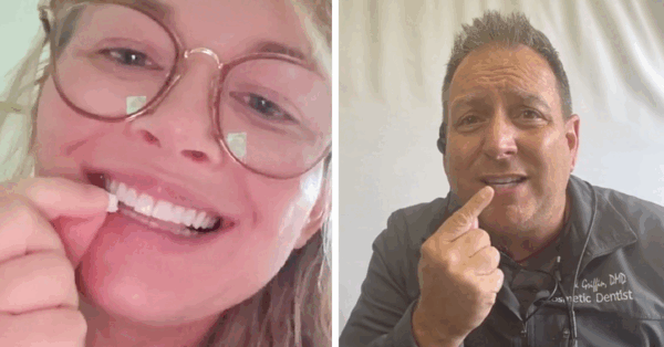 People Are Whitening Their Teeth With A Magic Eraser. Here’s What A Dentist Had To Say.