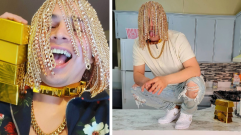 This Guy Had Gold Chains Surgically Implanted Into His Scalp And It Just Sounds Painful
