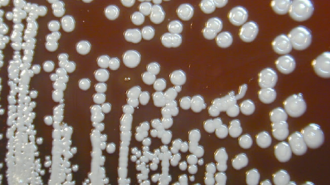 A Recall Has Been Issued After A Deadly Infection Has Been Linked To A Room Spray From Walmart