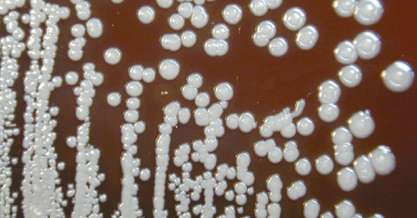 A Recall Has Been Issued After A Deadly Infection Has Been Linked To A Room Spray From Walmart