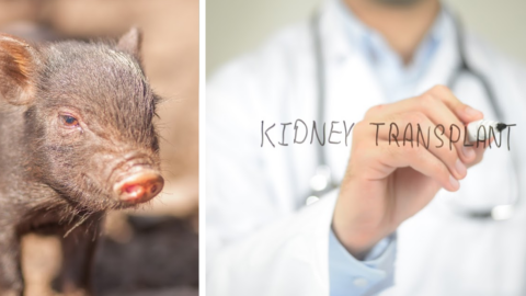 The First Pig To Human Kidney Transplant Has Been Done And It Is Fascinating