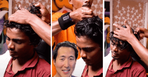 ‘Scalp Popping’ Is The Gross New Trend and It’s Actually Really Dangerous