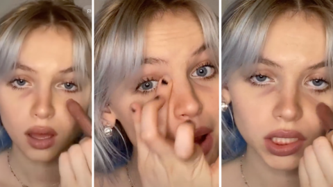 Apparently Dark Circles Under The Eyes Is The New Fashion Trend And I’m Gonna Have To Pass On This One