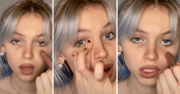 Apparently Dark Circles Under The Eyes Is The New Fashion Trend And I’m Gonna Have To Pass On This One