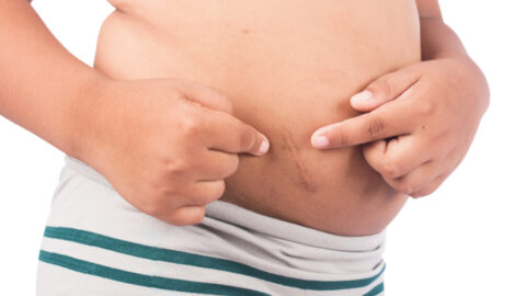 This Town Demanded Residents Get Surgery To Remove Their Appendix If They Want To Live There