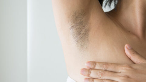 TikTok’s Viral “Armpit Detox” Is Not For The Faint of Heart
