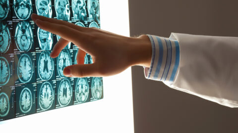 Some People Are Getting A Mysterious Brain Disorder That Makes It So They Can’t Walk, Talk, or Write The Letter ‘Q’