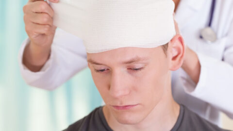 Doctors Are Sharing What to Do and What Not to Do When You Hit Your Head