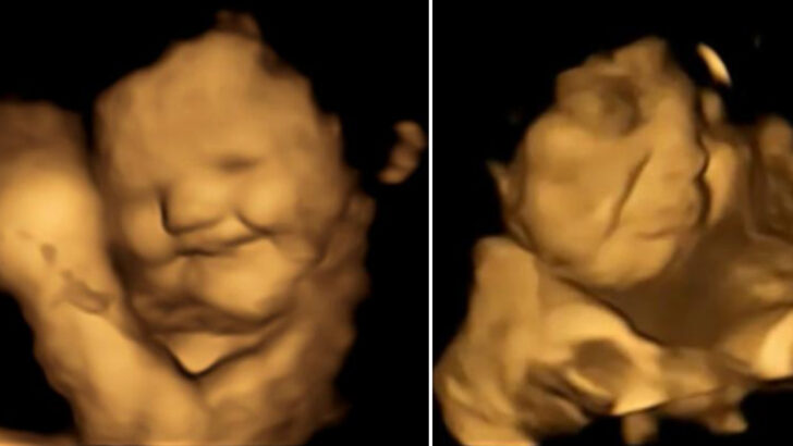 Study Says Fetuses Smile for Carrots But Frown Over Kale and I Totally Get It