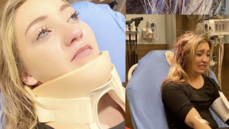 This Woman Shares Why You Should Never Wear A Claw Clip in The Car