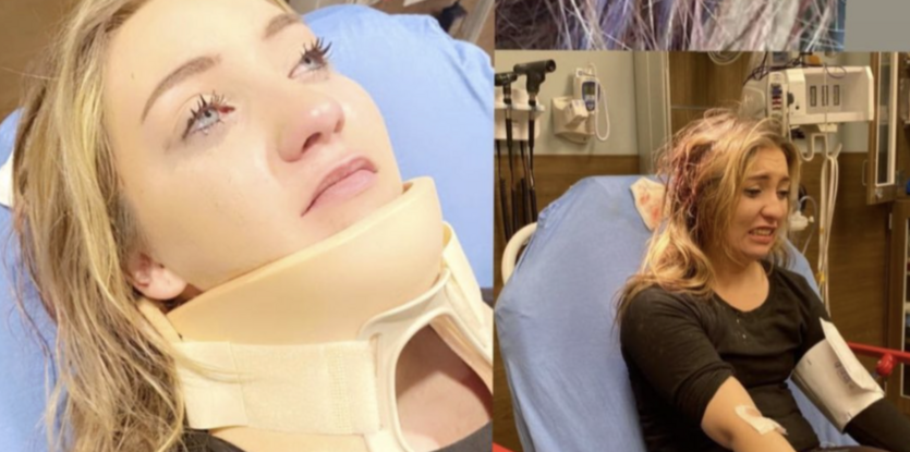This Woman Shares Why You Should Never Wear A Claw Clip in The Car