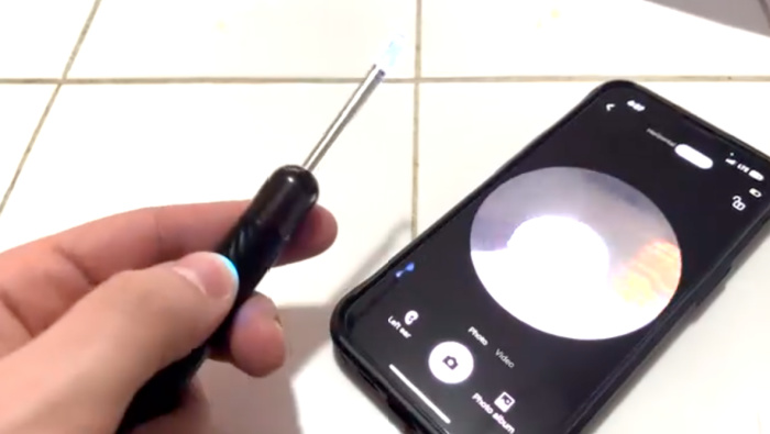 This Earwax Remover Uses Your Cell Phone As A Guide And It’s So Satisfying