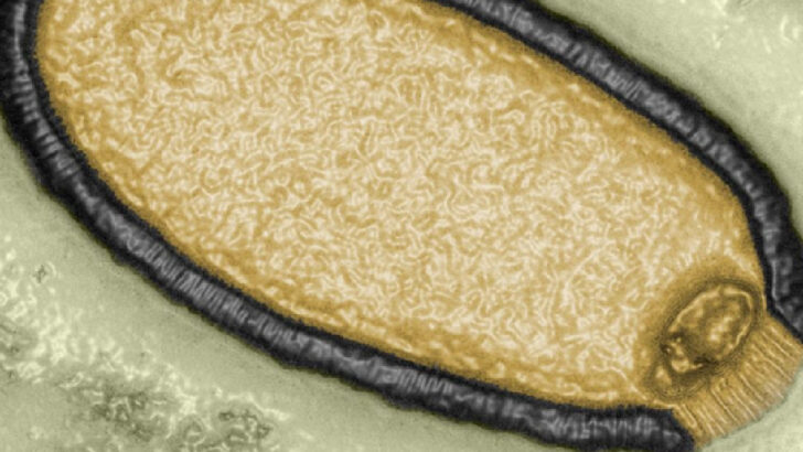 Researchers Have Brought Back A 48,500-Year-Old “Zombie Virus” And Does Anyone Else Think This Is A Bad Idea?