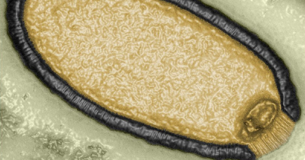 Researchers Have Brought Back A 48,500-Year-Old “Zombie Virus” And Does Anyone Else Think This Is A Bad Idea?