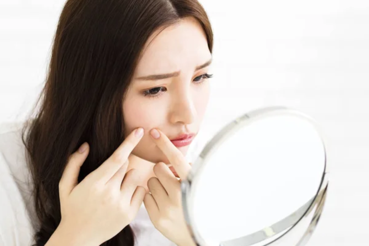 Woman Acne