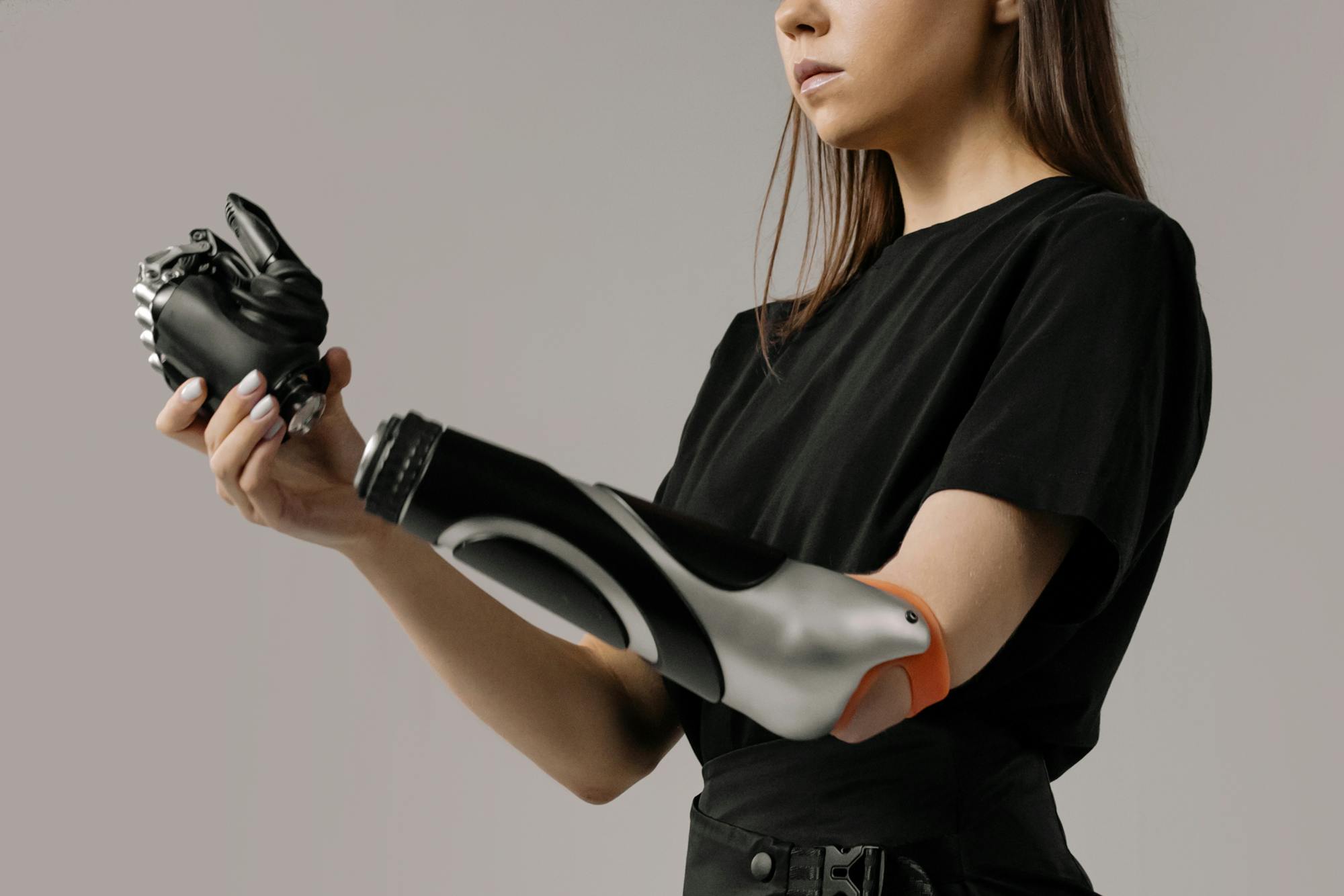 Young woman with a modern prosthetic arm showcasing advanced technology.